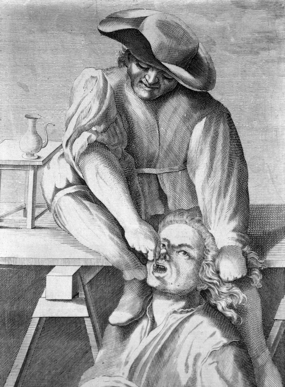 Tandtrækkeren (gravering, 1700-tallet) af Anonymous Anonymous