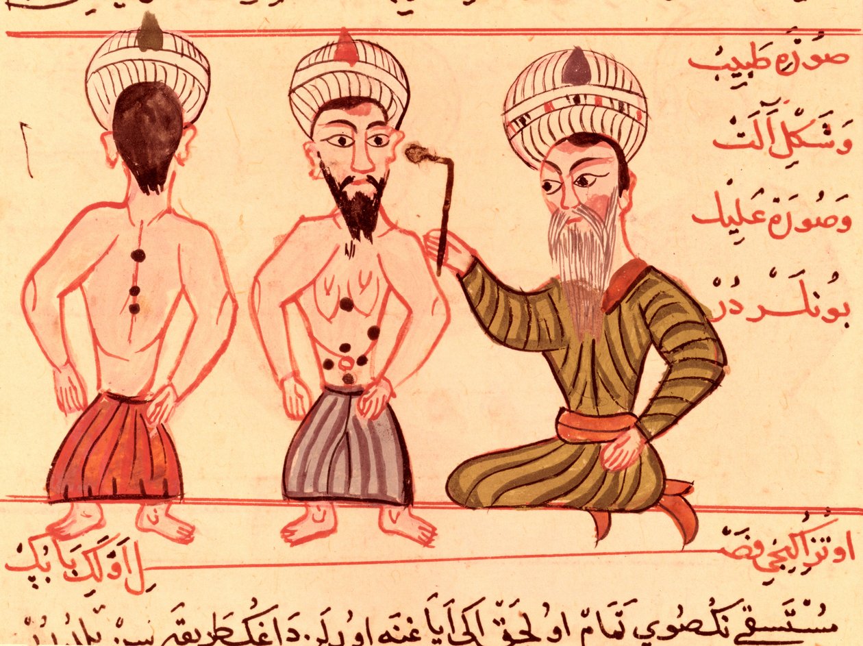 Ms Sup Turc 693 fol.35 Operation for Cauterisation, 1466 af Charaf ed Din