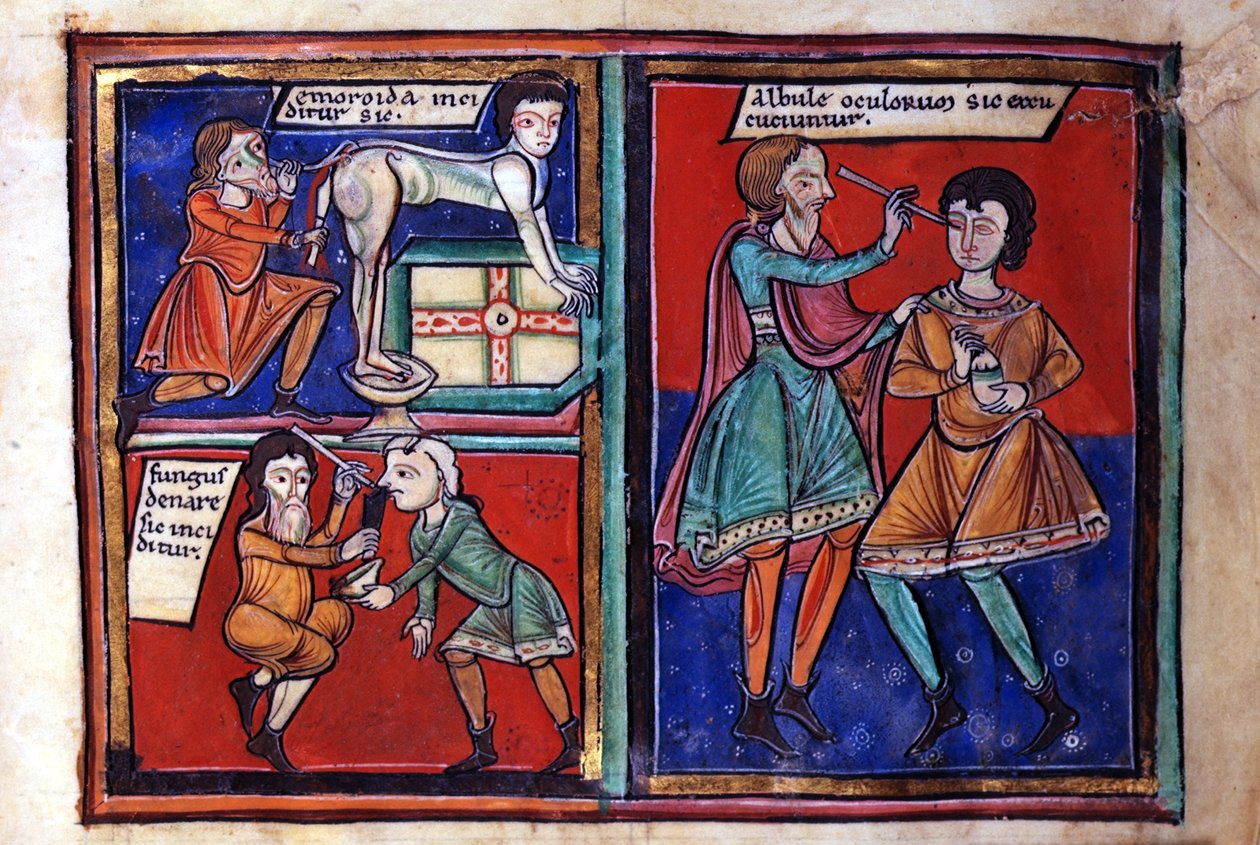 Sloane Ms 1975 fol.93 Medicinske operationer af English School