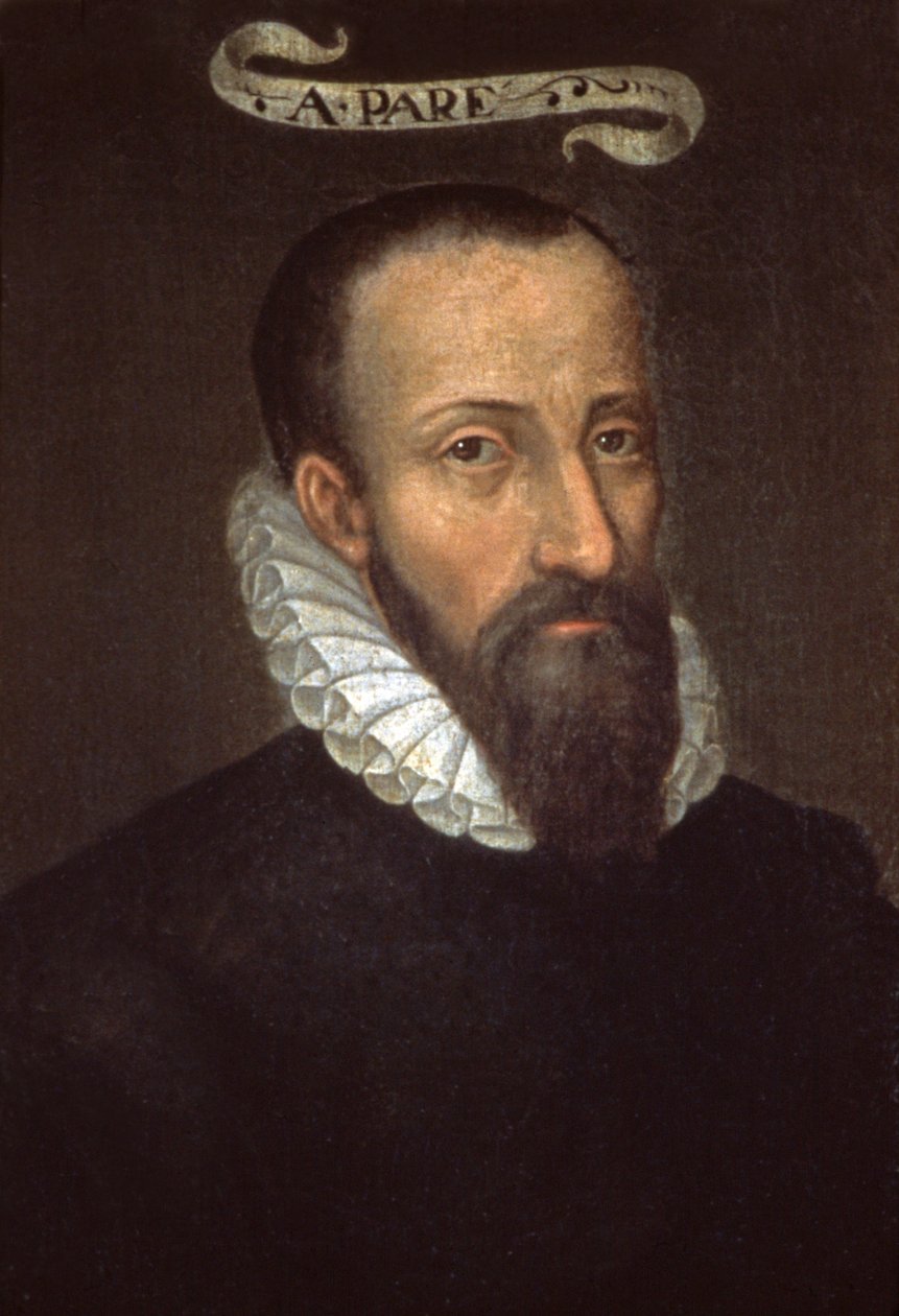 Ambroise Pare. 16. århundrede (maleri) af French School