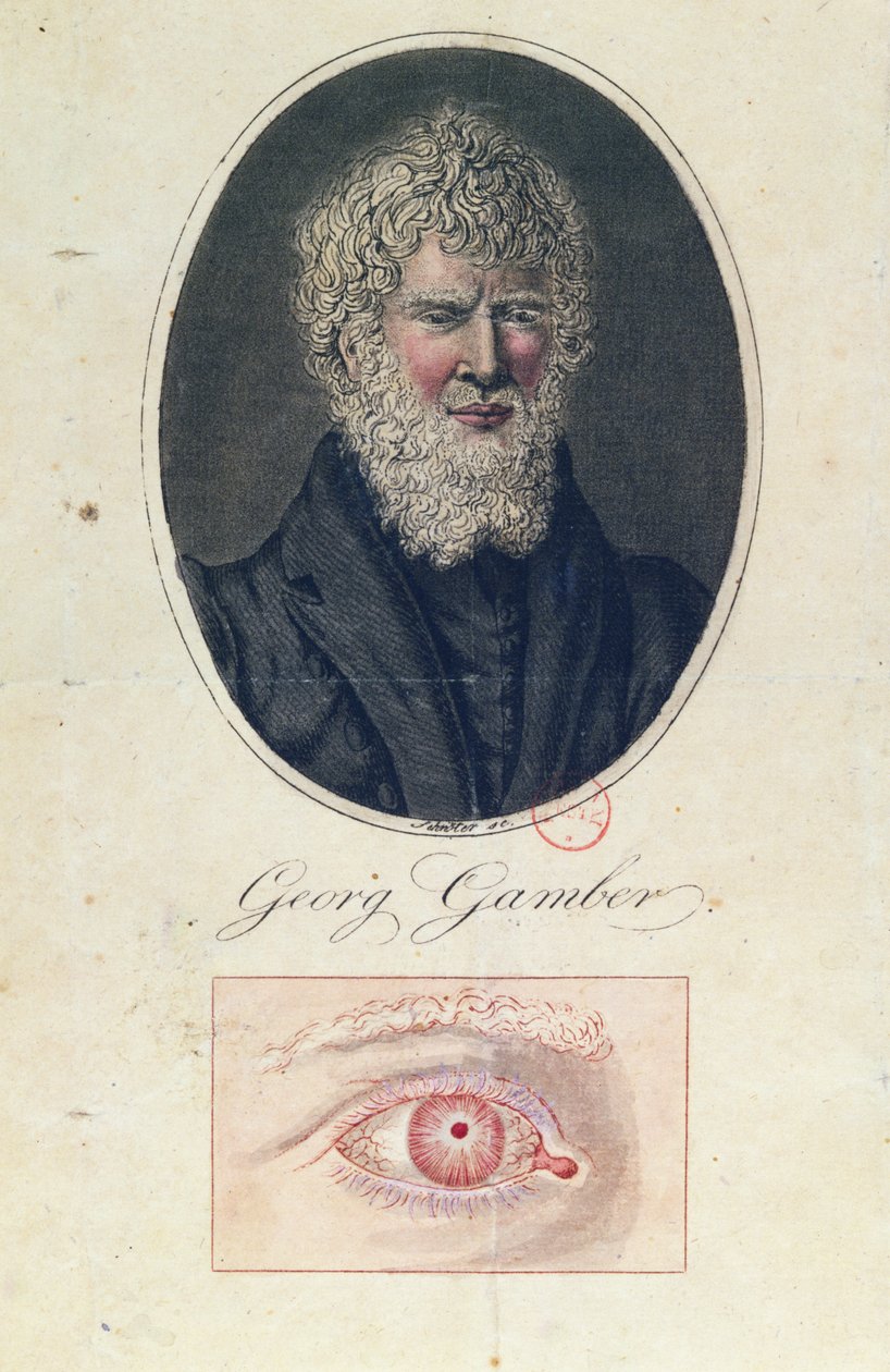Georg Gamber, en albino af German School