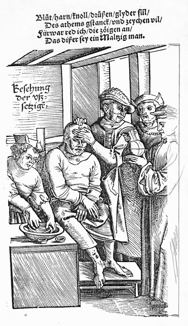 Behandling af en patient (træsnit) (bw foto) af German School