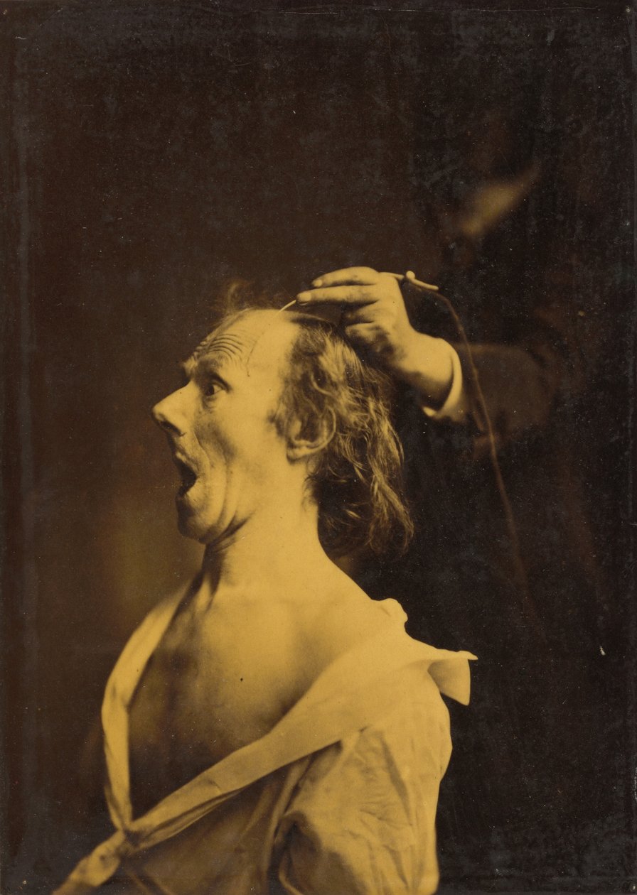 Forundring, forbløffelse, forbløffelse af Guillaume Benjamin Amant Duchenne