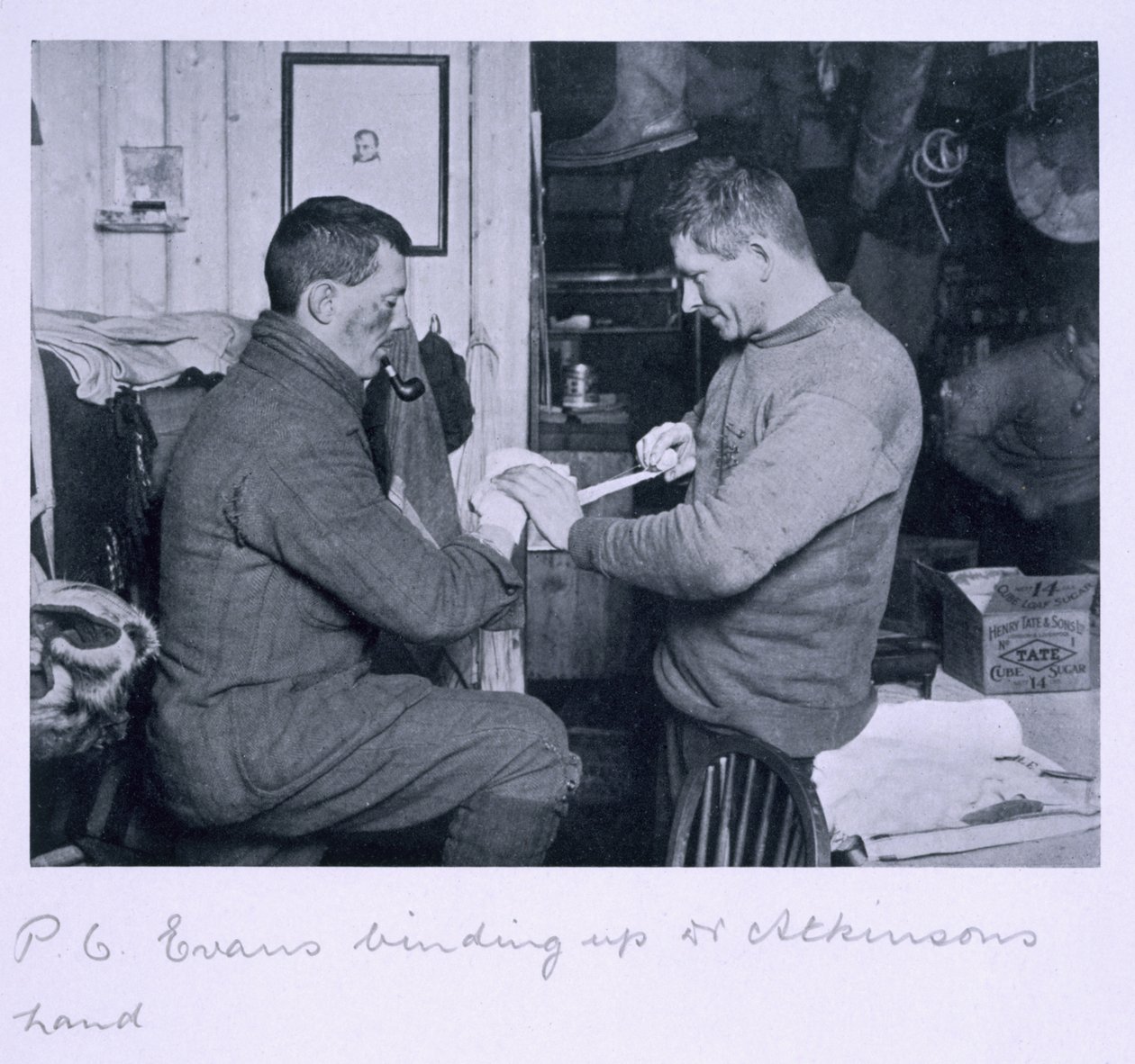 Evans binder Dr. Atkinsons frostbitte hånd op fra 