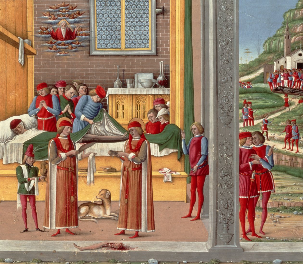 Middelalderlig amputationsscene (tempera på panel) af Italian School