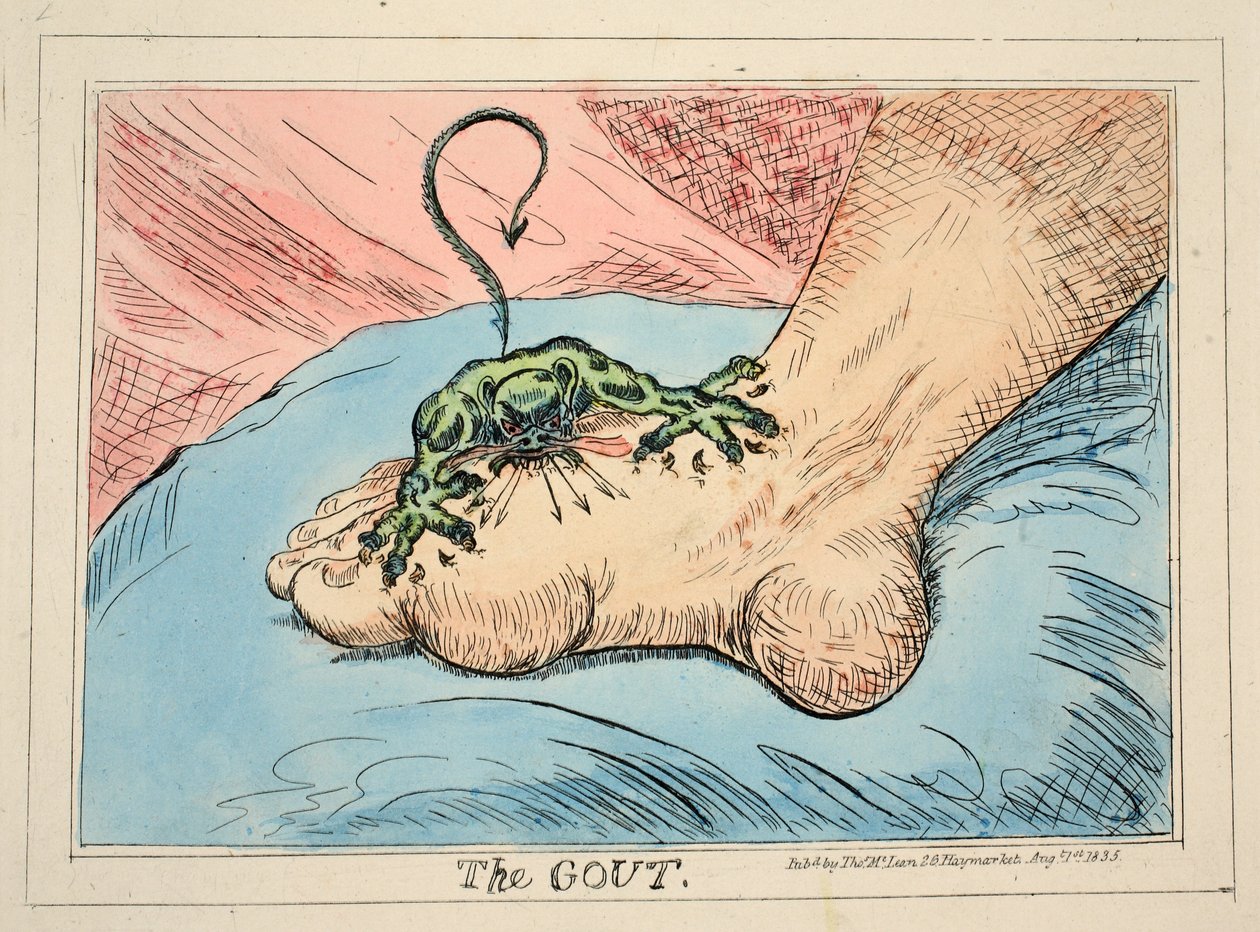 The Gout, pub. 1835 (håndfarvet gravering) af James Gillray
