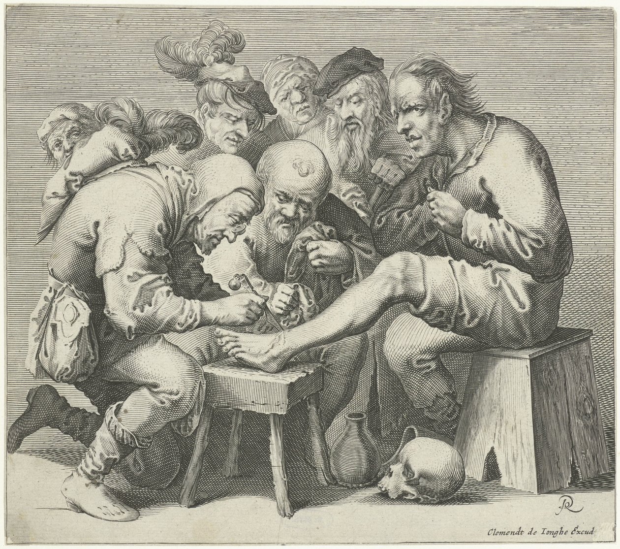 fodoperation af Pieter Jansz Quast
