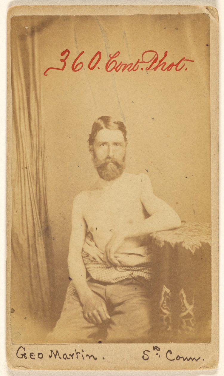 Geo. Martin, 5. kreds. [Offer for borgerkrigen] af S. Friedlaender