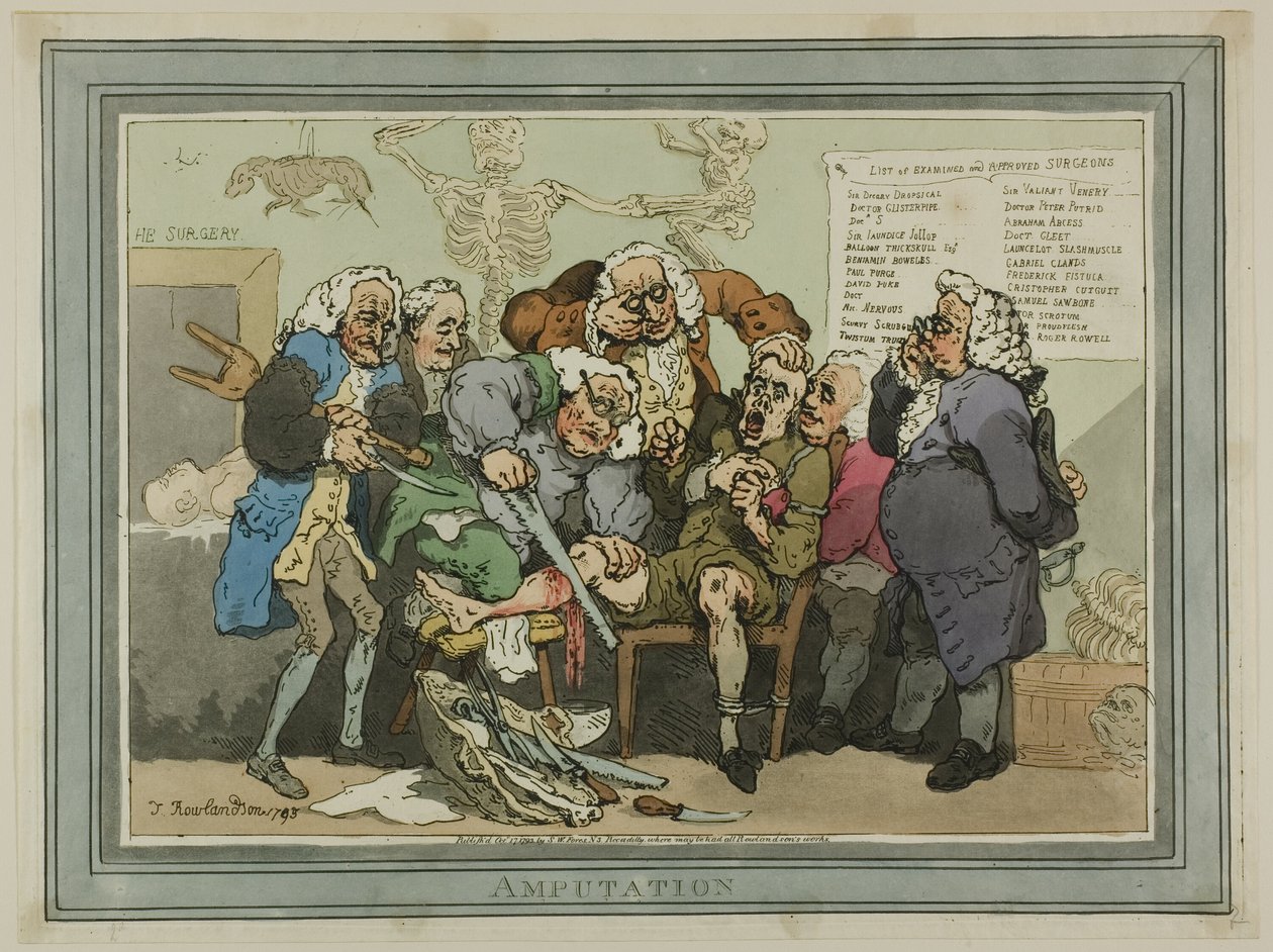 Amputation af Thomas Rowlandson