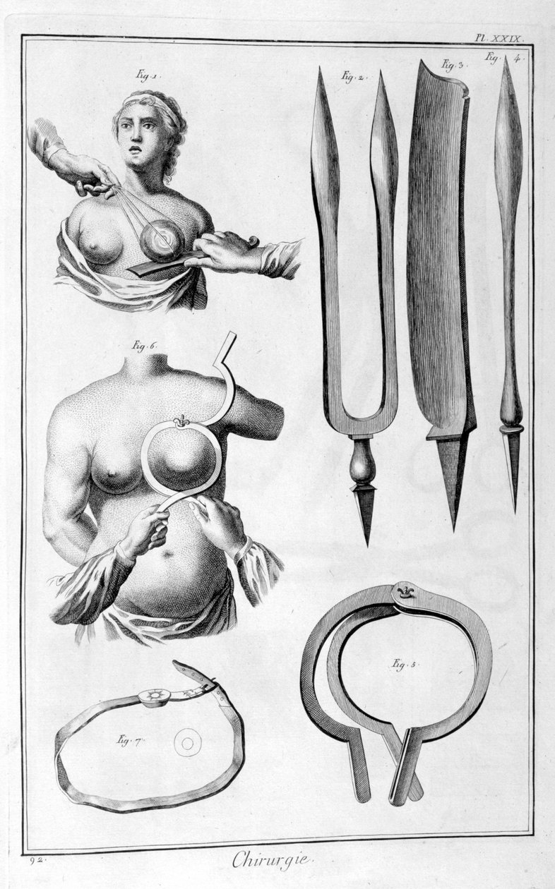 Brystkirurgi, 1751-1777 af Unbekannt