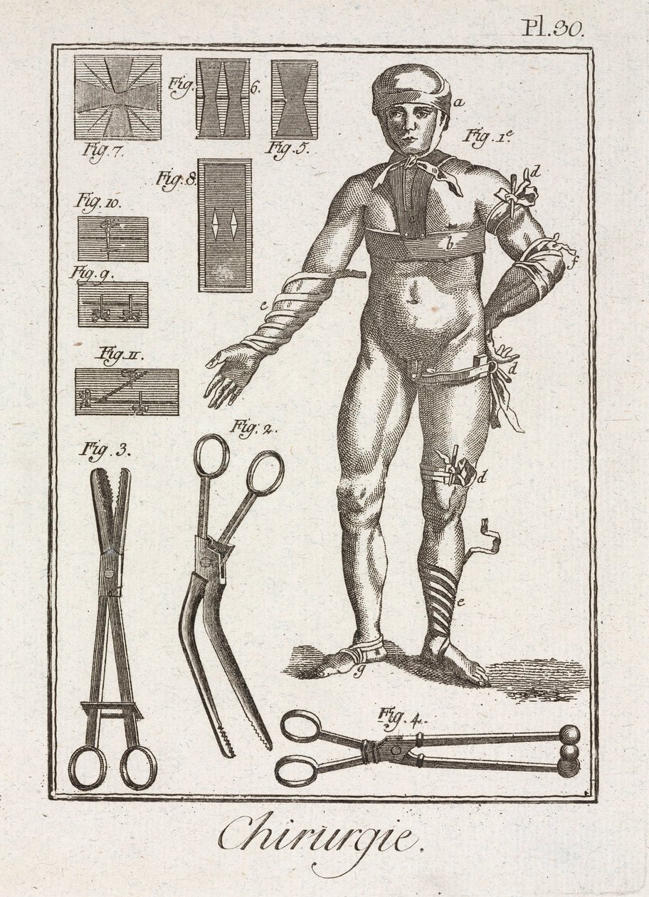 Udstyr, Tidlig-Moderne Forbinding af en menneskelig figur af Unbekannt