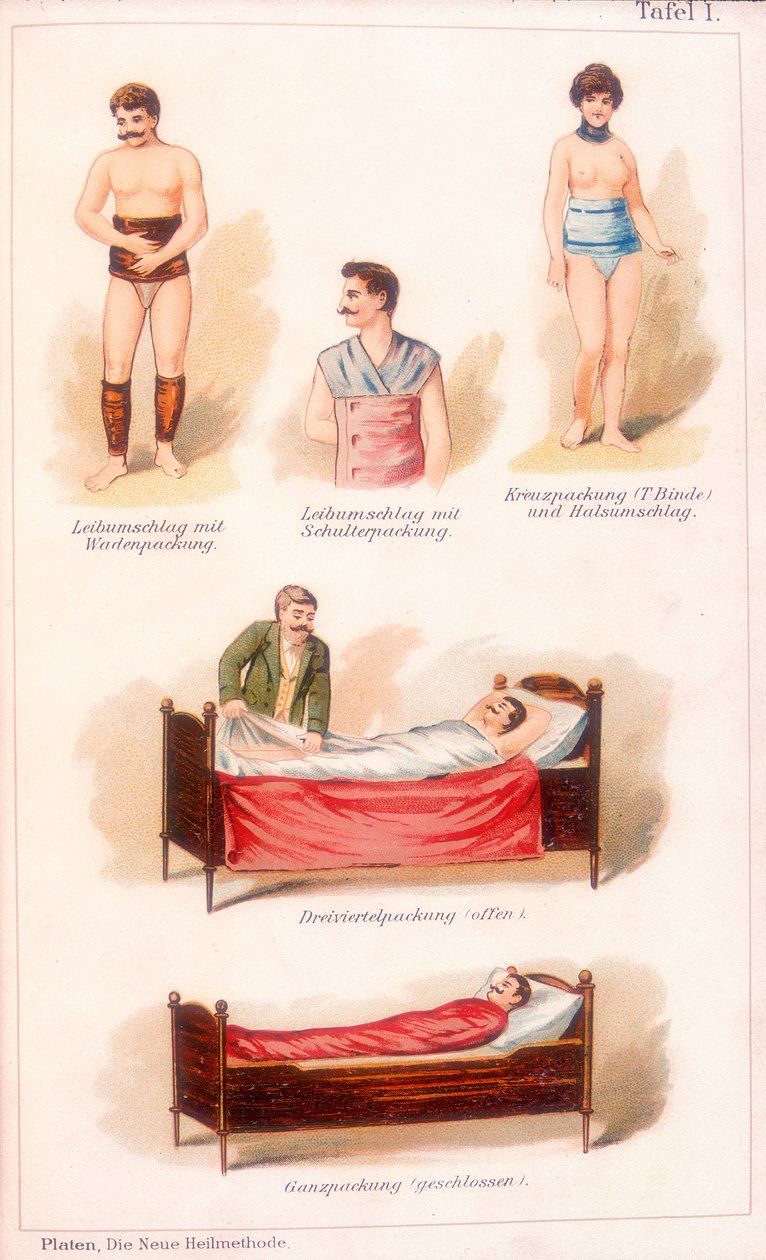 Hydroterapibehandlinger, c1902 af Unbekannt