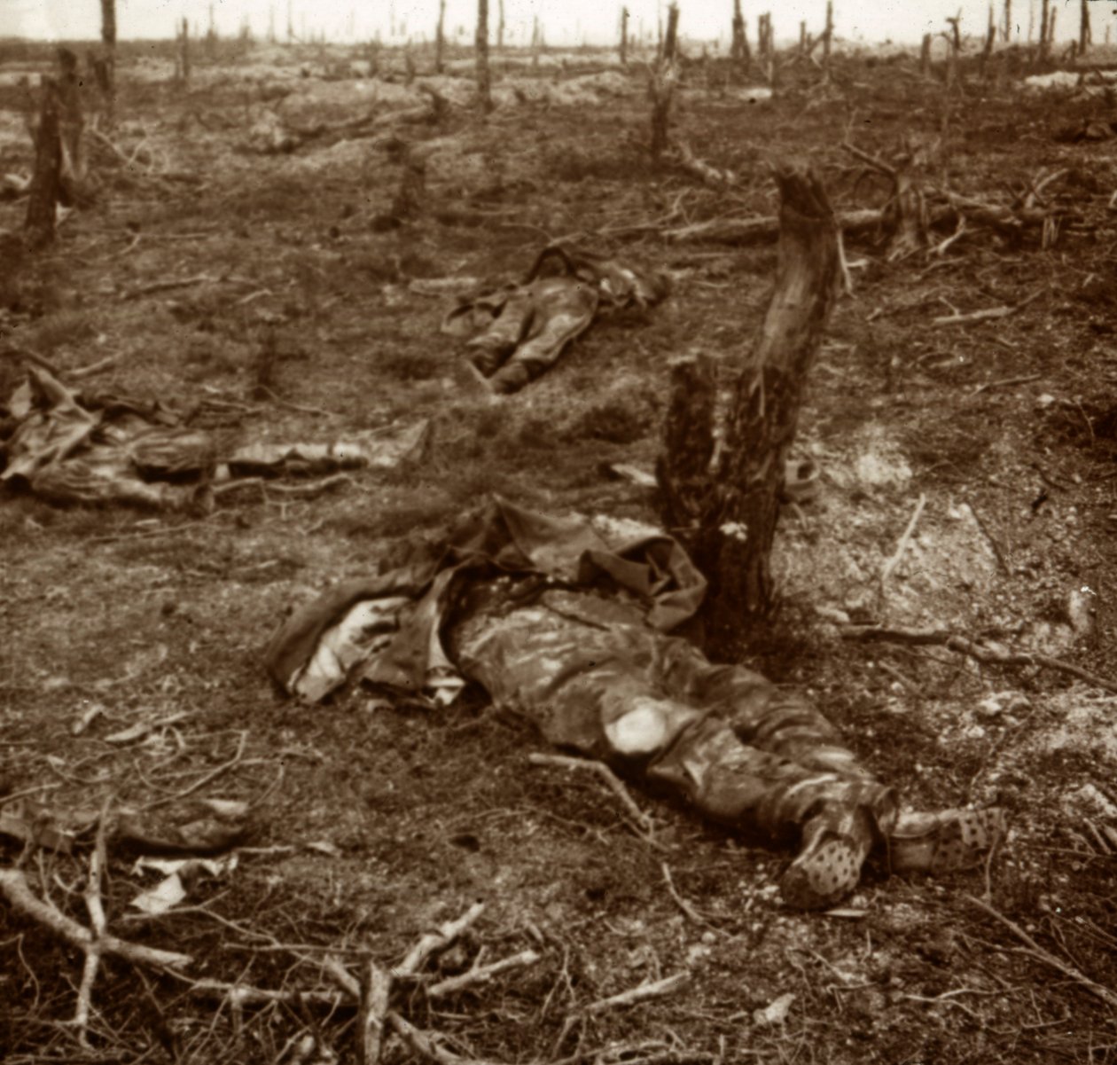 Vej mellem kroppe, c1914-c1918 af Unbekannt