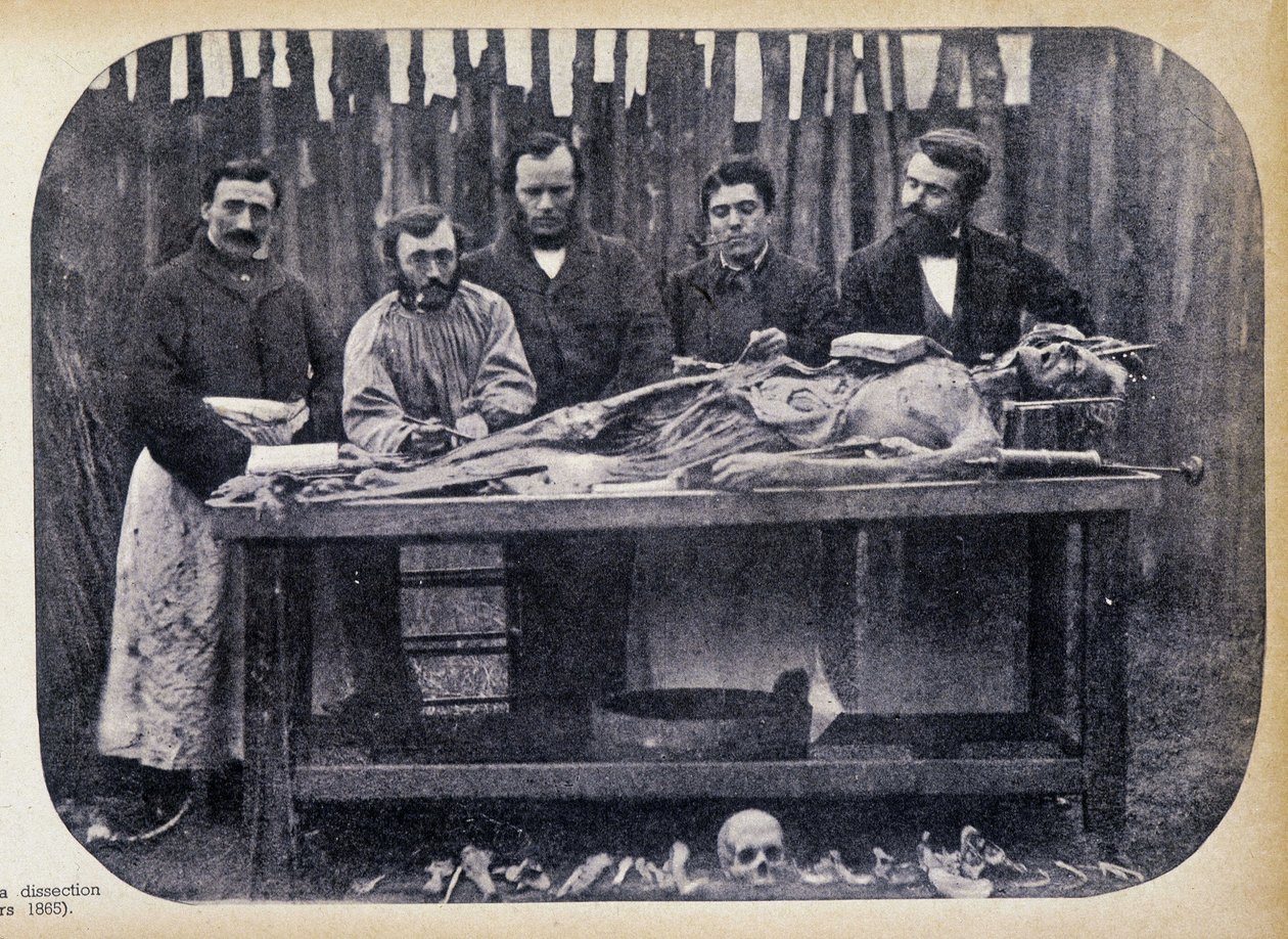 Dissektion, v.1865. af Unknown photographer