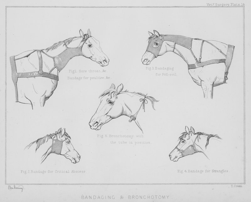 Bandagering og bronkotomi (litho) af Benjamin Herring