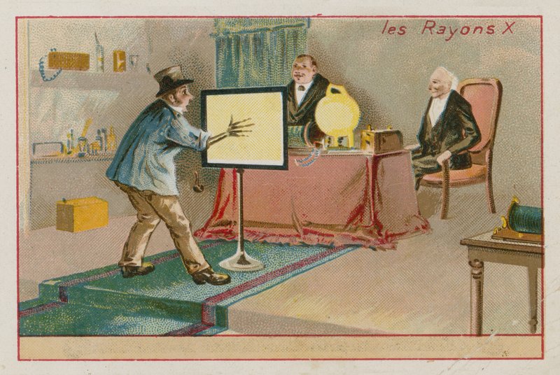 Røntgenstråler af French School