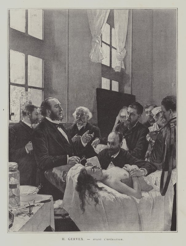 Avant l Operation (før operationen) af Henri Gervex