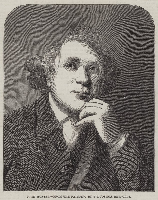 John Hunter af Joshua Reynolds